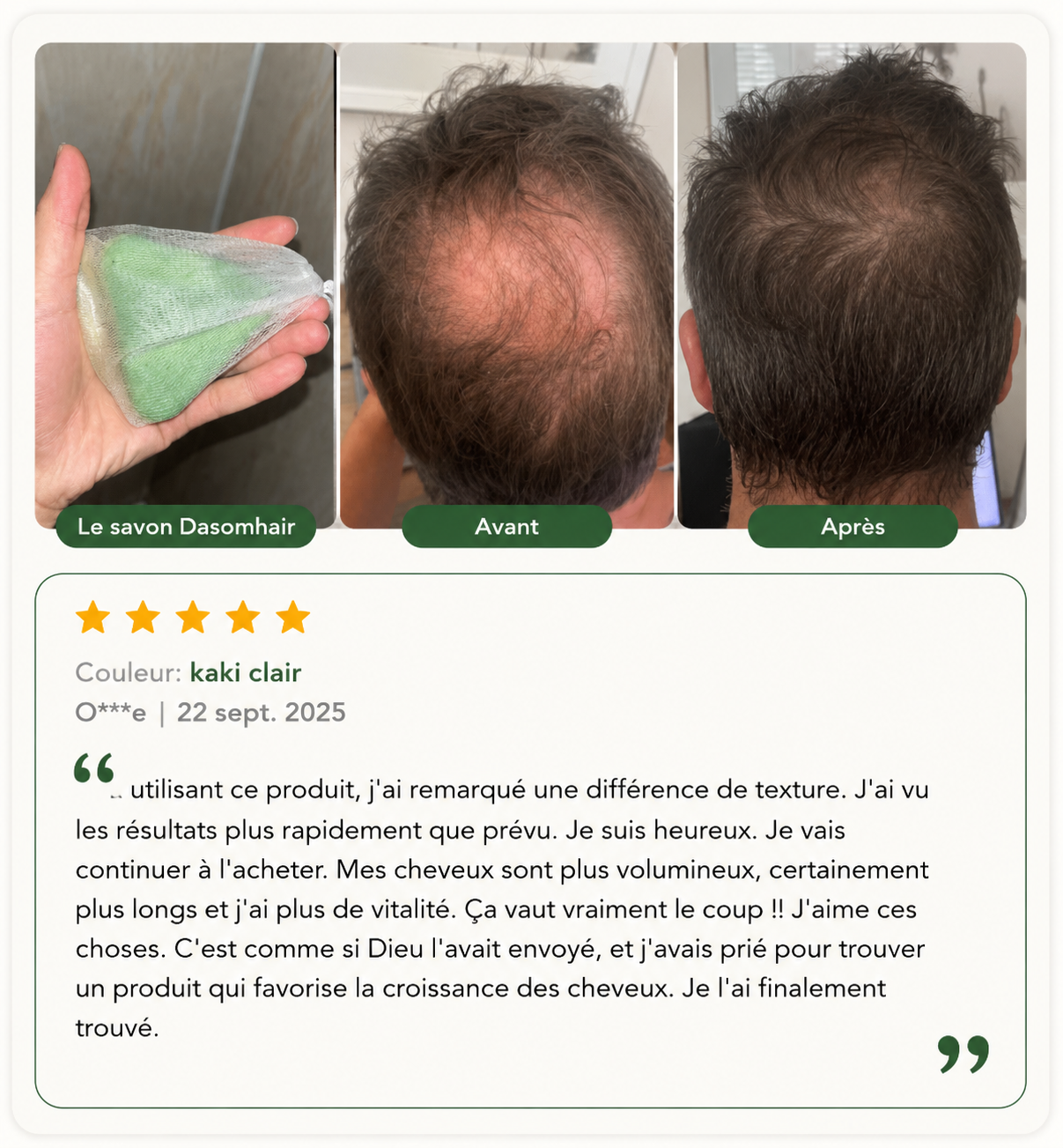 Avis client 5 étoiles avant/après sur le savon dasomhair — O***e, 22 septembre 2025